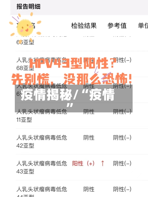 疫情揭秘/“疫情”-第2张图片