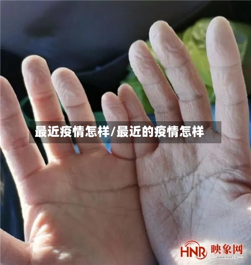 最近疫情怎样/最近的疫情怎样-第3张图片
