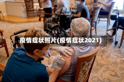 疫情症状照片(疫情症状2021)-第2张图片
