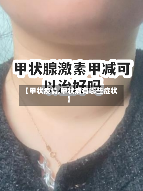 【甲状疫情,甲状病有哪些症状】-第2张图片