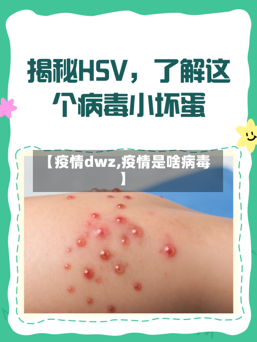 【疫情dwz,疫情是啥病毒】-第2张图片