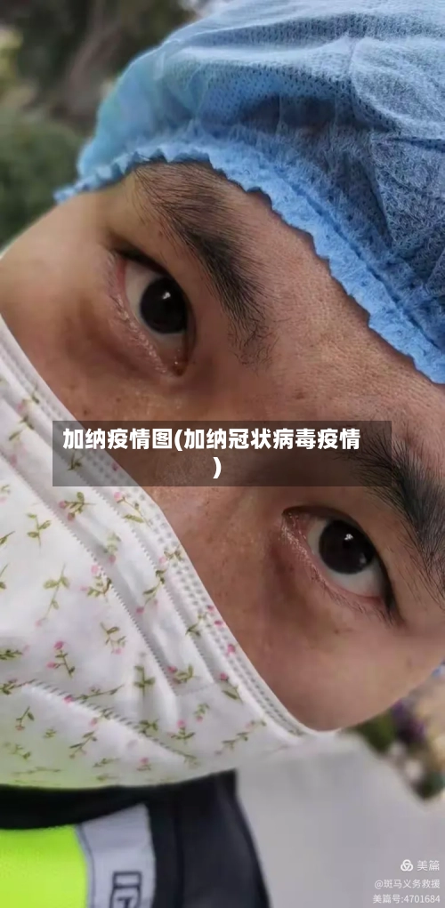 加纳疫情图(加纳冠状病毒疫情)-第2张图片