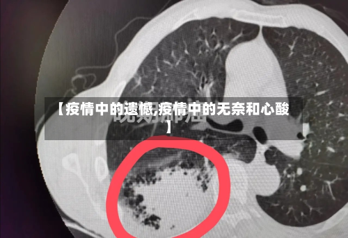 【疫情中的遗憾,疫情中的无奈和心酸】