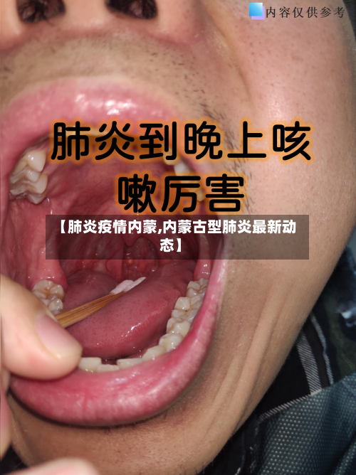 【肺炎疫情内蒙,内蒙古型肺炎最新动态】