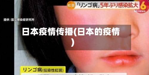 日本疫情传播(日本的疫情)-第2张图片