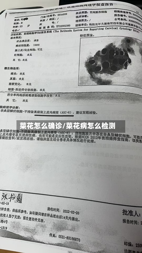 菜花怎么确诊/菜花病怎么检测