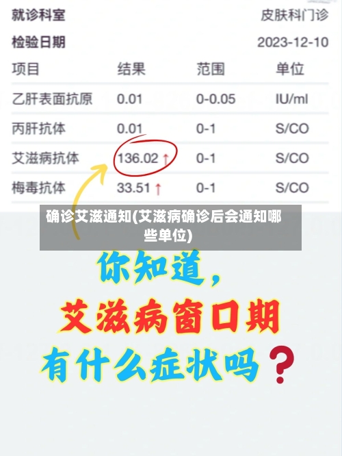 确诊艾滋通知(艾滋病确诊后会通知哪些单位)-第2张图片