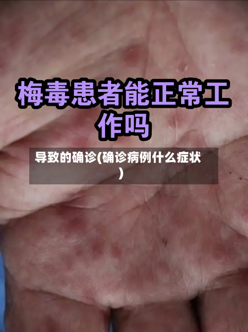 导致的确诊(确诊病例什么症状)-第2张图片