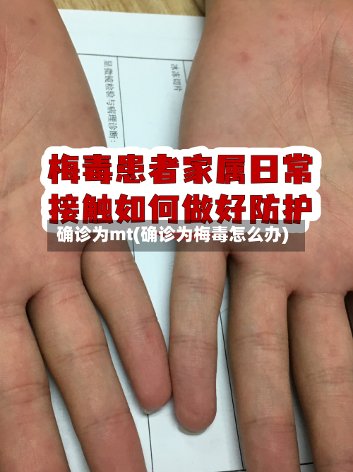 确诊为mt(确诊为梅毒怎么办)