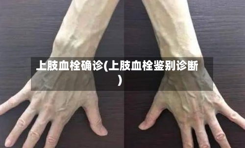 上肢血栓确诊(上肢血栓鉴别诊断)