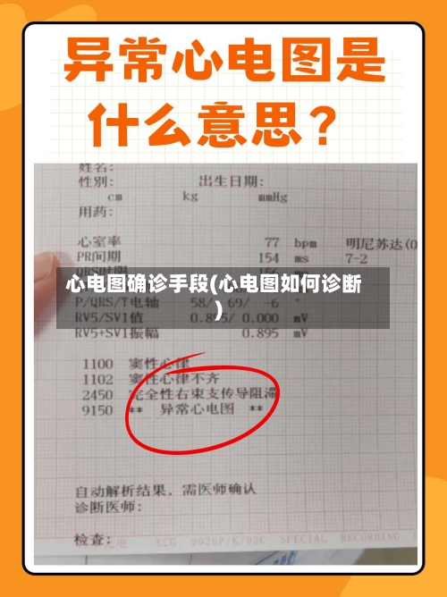 心电图确诊手段(心电图如何诊断)