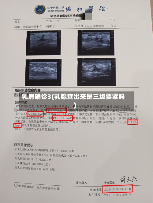 乳房确诊3(乳腺查出来是三级要紧吗)-第2张图片